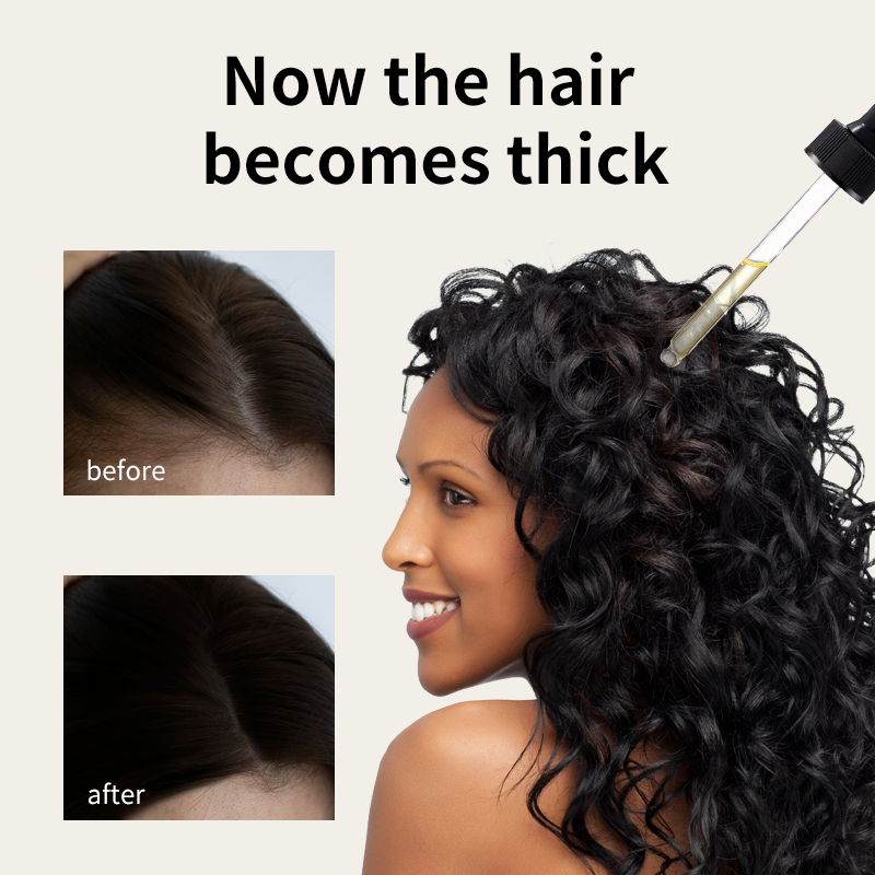 زيت سيولي لنمو الشعر | زيت الروزماري والزنجبيل المضاد لتساقط الشعر | تحفيز البصيلات