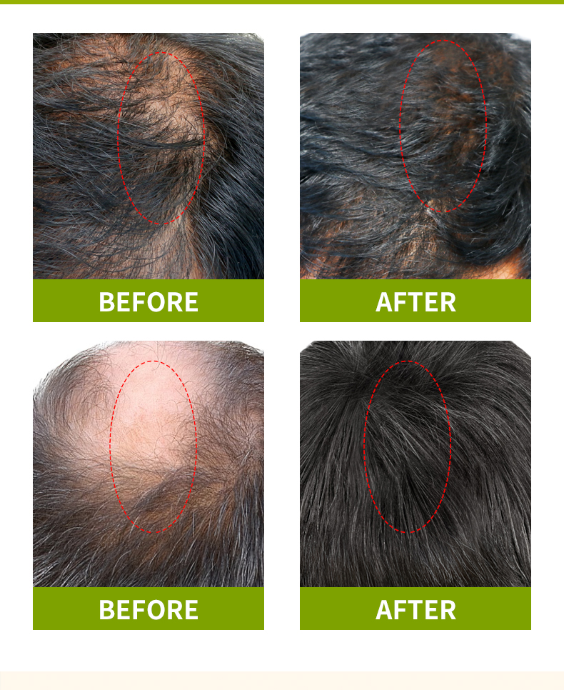 سيولي草本护发油第二版_08