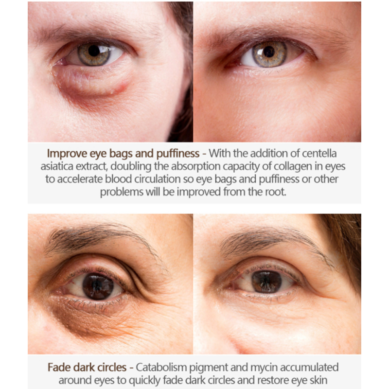 كريم العين المضاد للتجاعيد مع أداة التطبيق (2) 